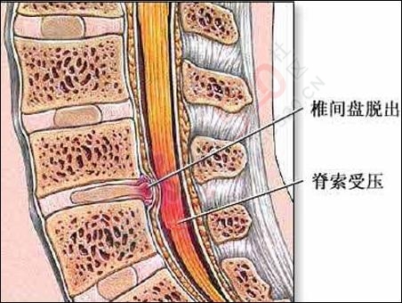 为什么脖子发硬一转就嘎巴响431 / 作者:人艰不拆 / 帖子ID:163035