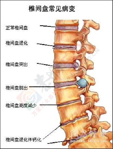 为什么脖子发硬一转就嘎巴响235 / 作者:人艰不拆 / 帖子ID:163035