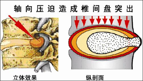 为什么脖子发硬一转就嘎巴响994 / 作者:人艰不拆 / 帖子ID:163035