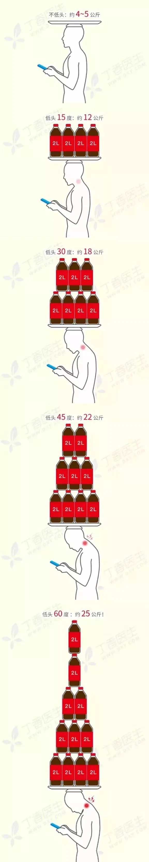 低头玩手机=头顶 50 斤！教你 3 个玩手机的正确姿势338 / 作者:儿时的回忆 / 帖子ID:273189