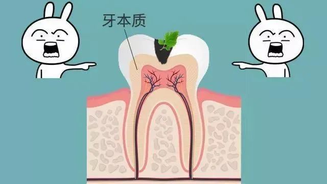 大部分中国人都有的口腔问题，越早治疗越省钱693 / 作者:等风十里 / 帖子ID:276013