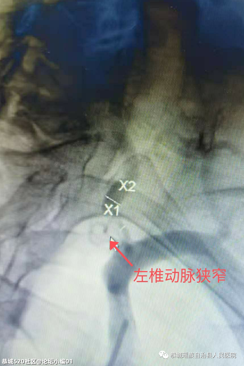 小针口大疗效，必要时可救命〡恭城只有这里能做，别不知道！798 / 作者:论坛小编01 / 帖子ID:286048