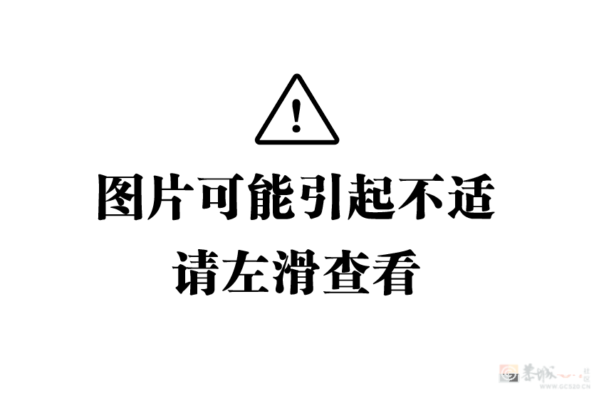 夏季实用帖：劝你在天热前治好脚气……580 / 作者:健康小天使 / 帖子ID:307145